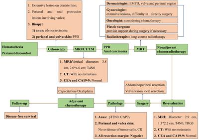 Case report: The application of neoadjuvant chemoradiotherapy in anal adenocarcinoma combined with perianal Paget disease involving vulvar skin